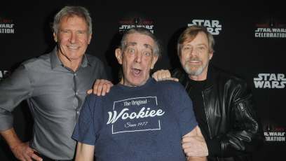 Chewbacca actor Peter Mayhew undergoes spinal surgery